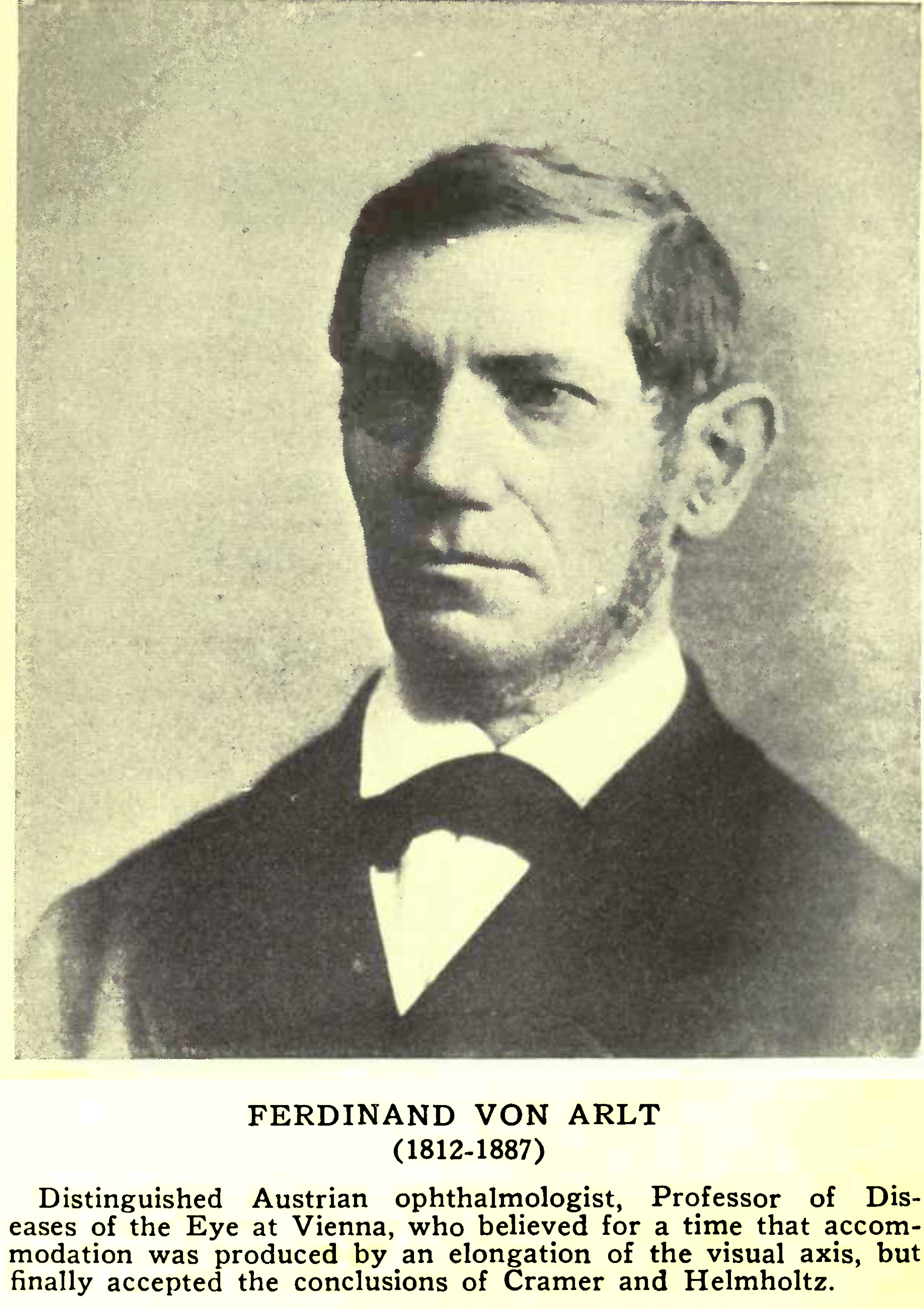 Ophthalmologist Ferdinand Von Arlt - Originally studied the theory that the eye accommodates by lengthening, 'like a camera'. 