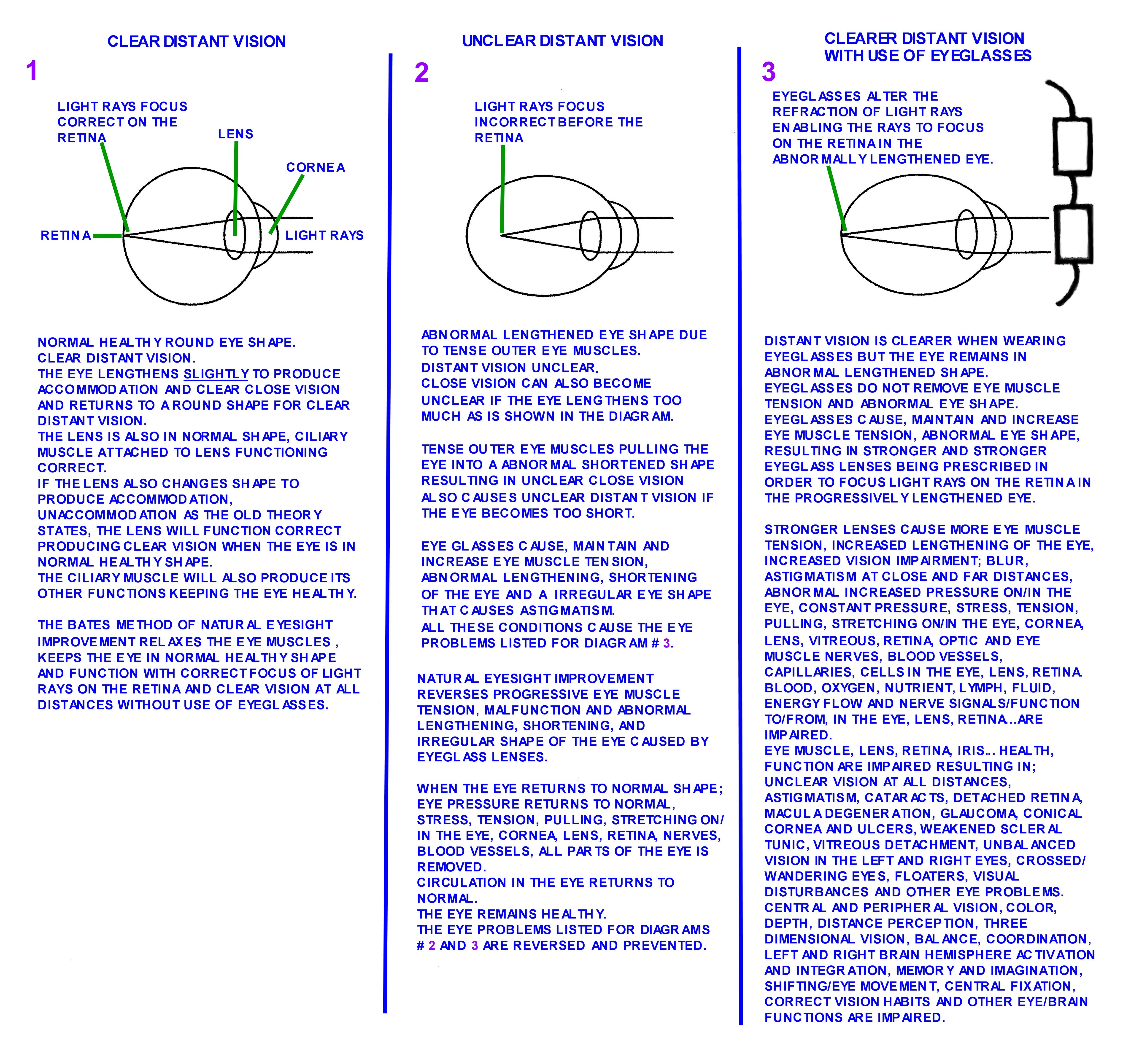 EYEGLASSES_VISION_IMPAIRMENT.jpg EYEGLASSES_VISION_IMPAIRMENT.jpg
