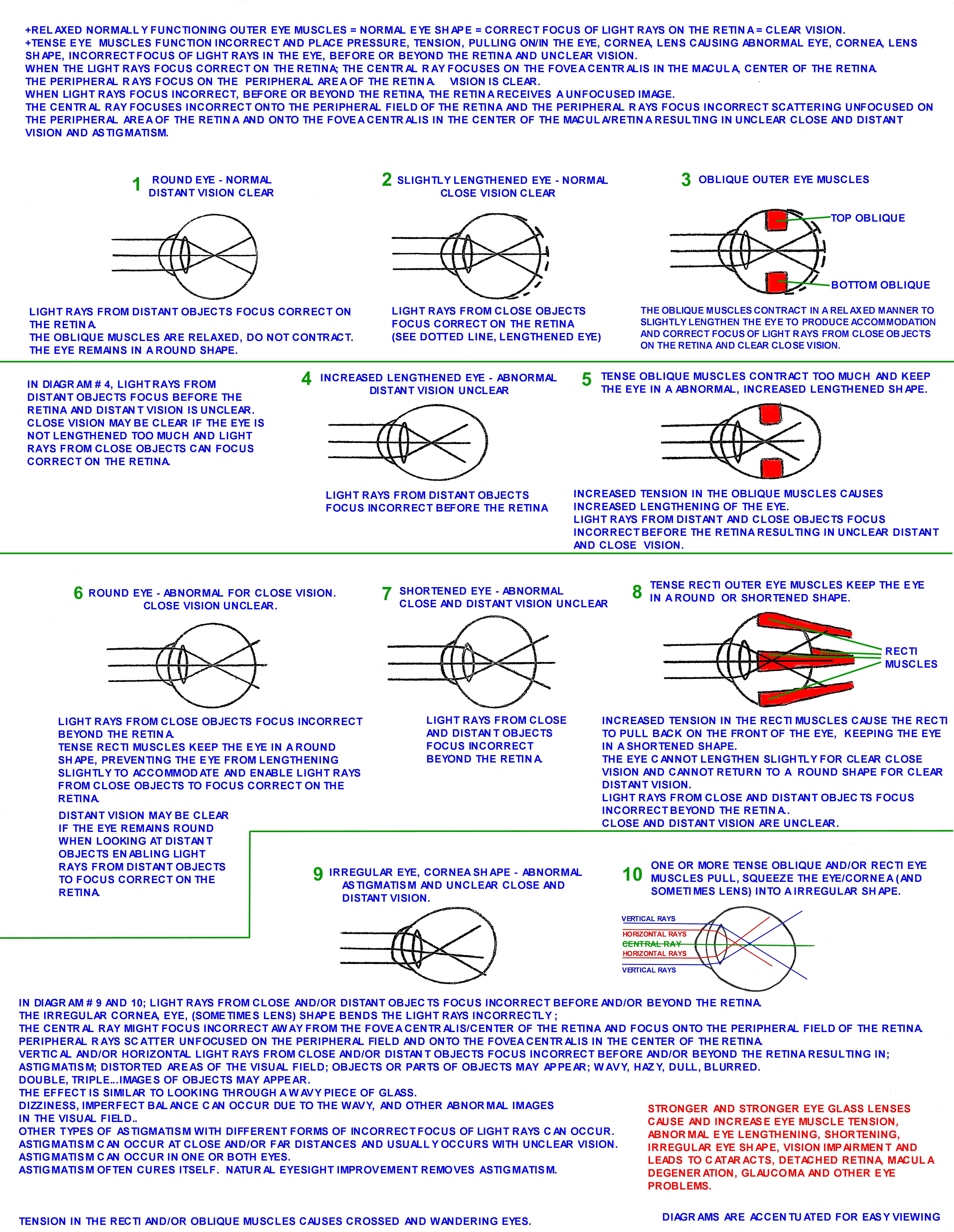 NORMAL_AND_ABNORMAL_EYE_SHAPE_001.jpg NORMAL_AND_ABNORMAL_EYE_SHAPE_001.jpg