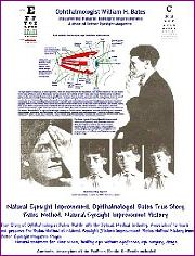 Ophthalmologist William H. Bates True Story, Bates Method, Natural Eyesight Improvement History-Kindle 