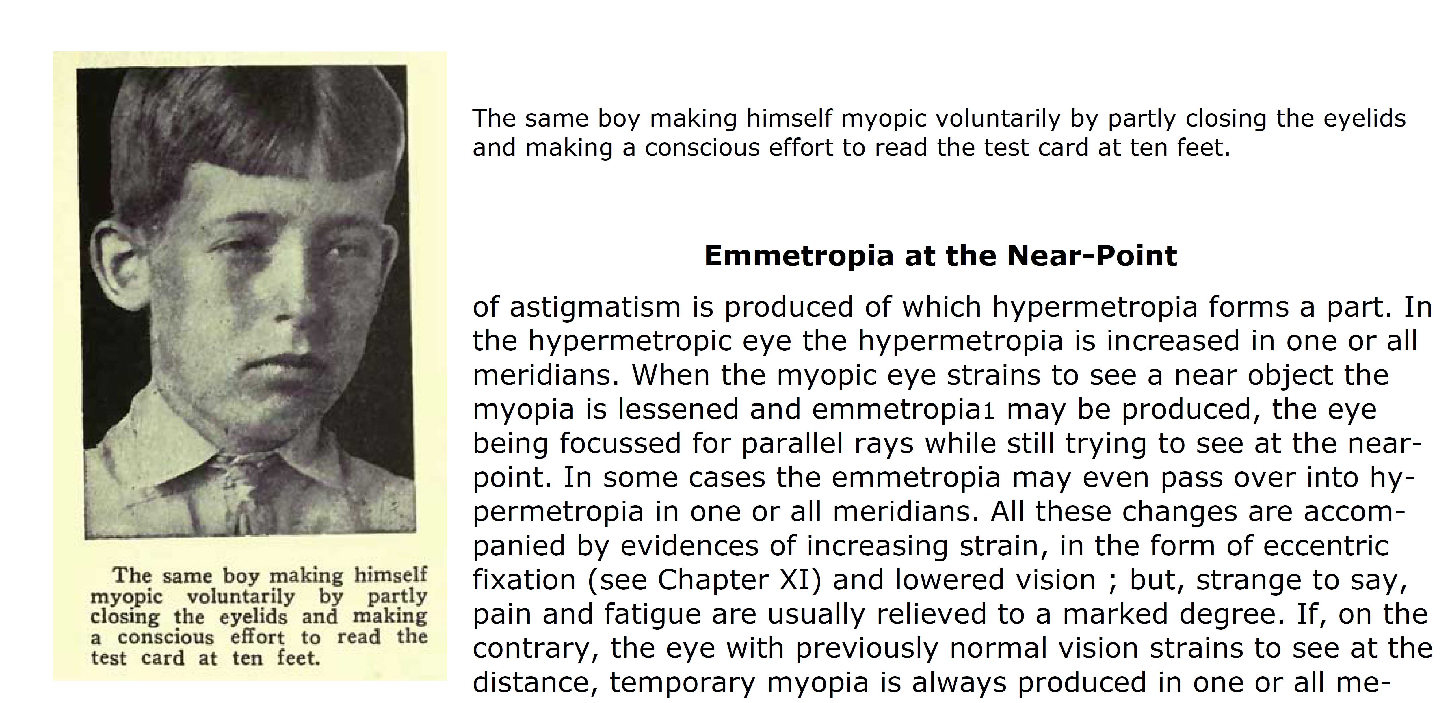 Boy Squinting; Causes Unclear vision