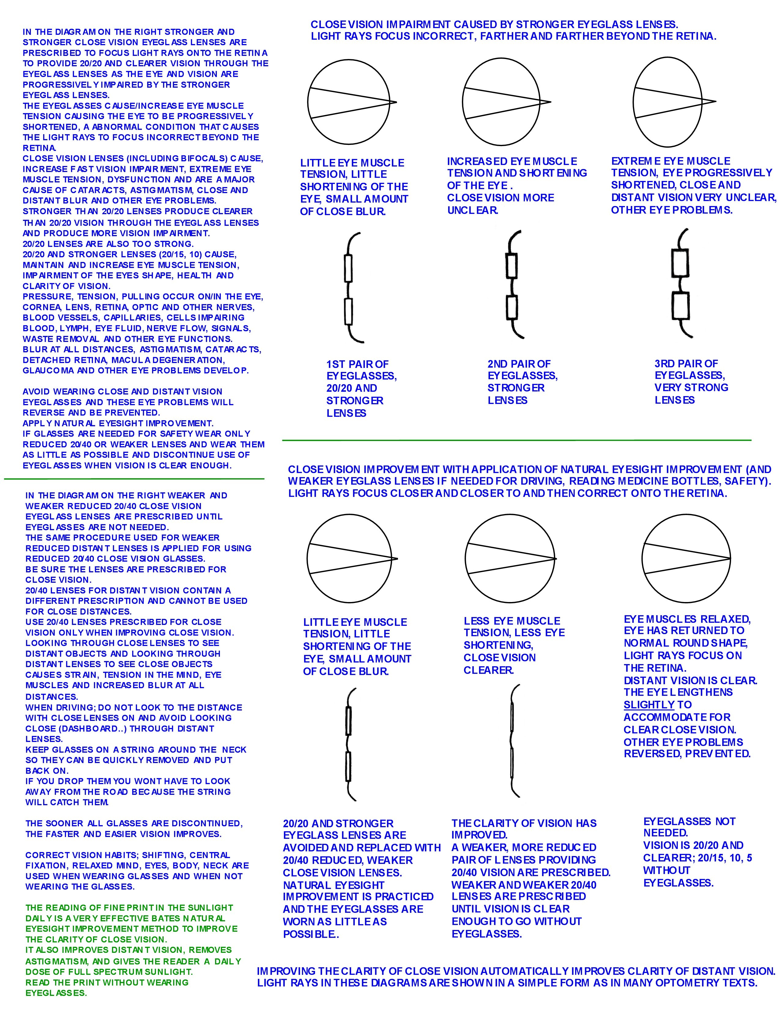 EYE MUSCLE TENSIION SHORTENED EYE SHAPE CLOSE BLUR