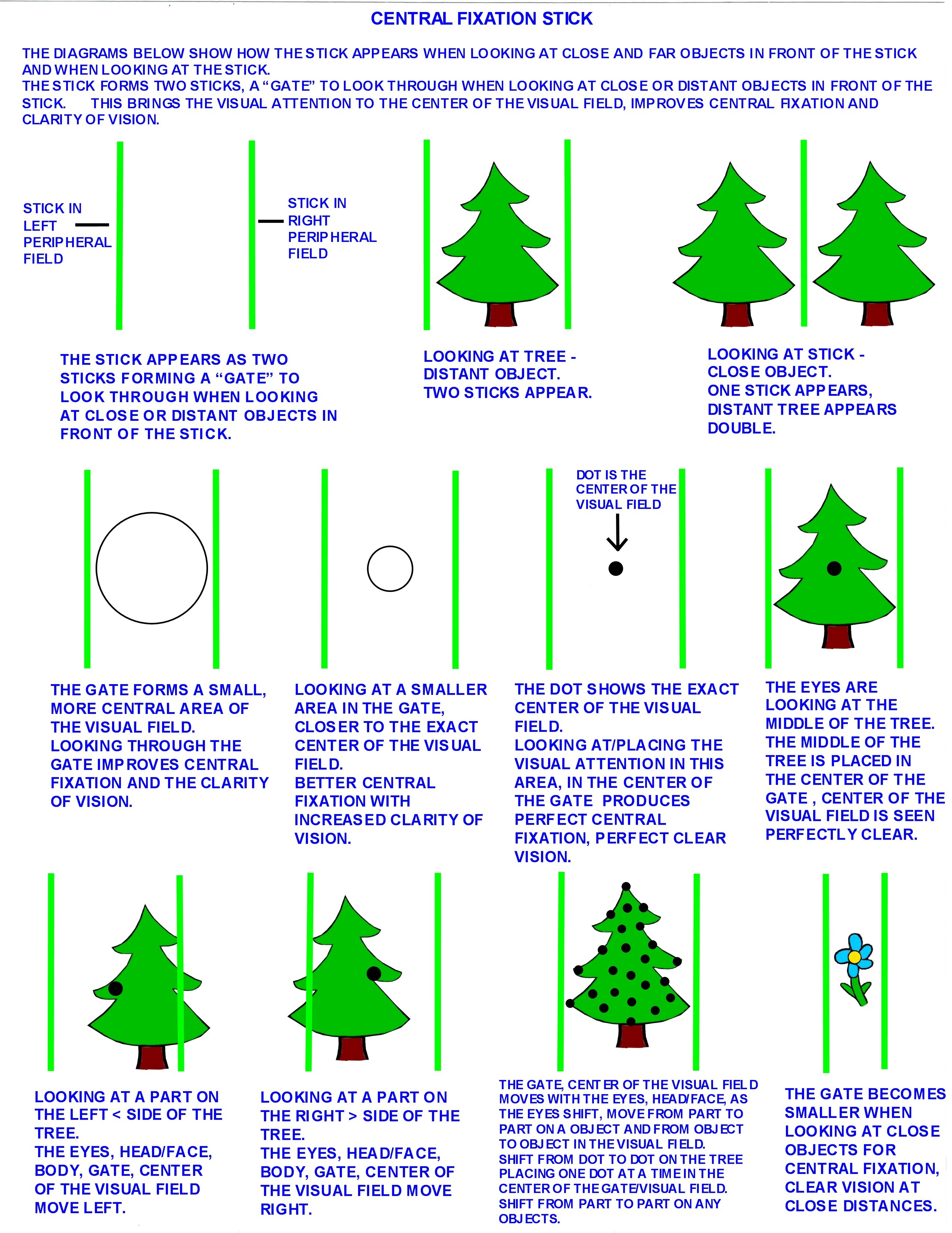 CENTRAL FIXATION STICK GATE