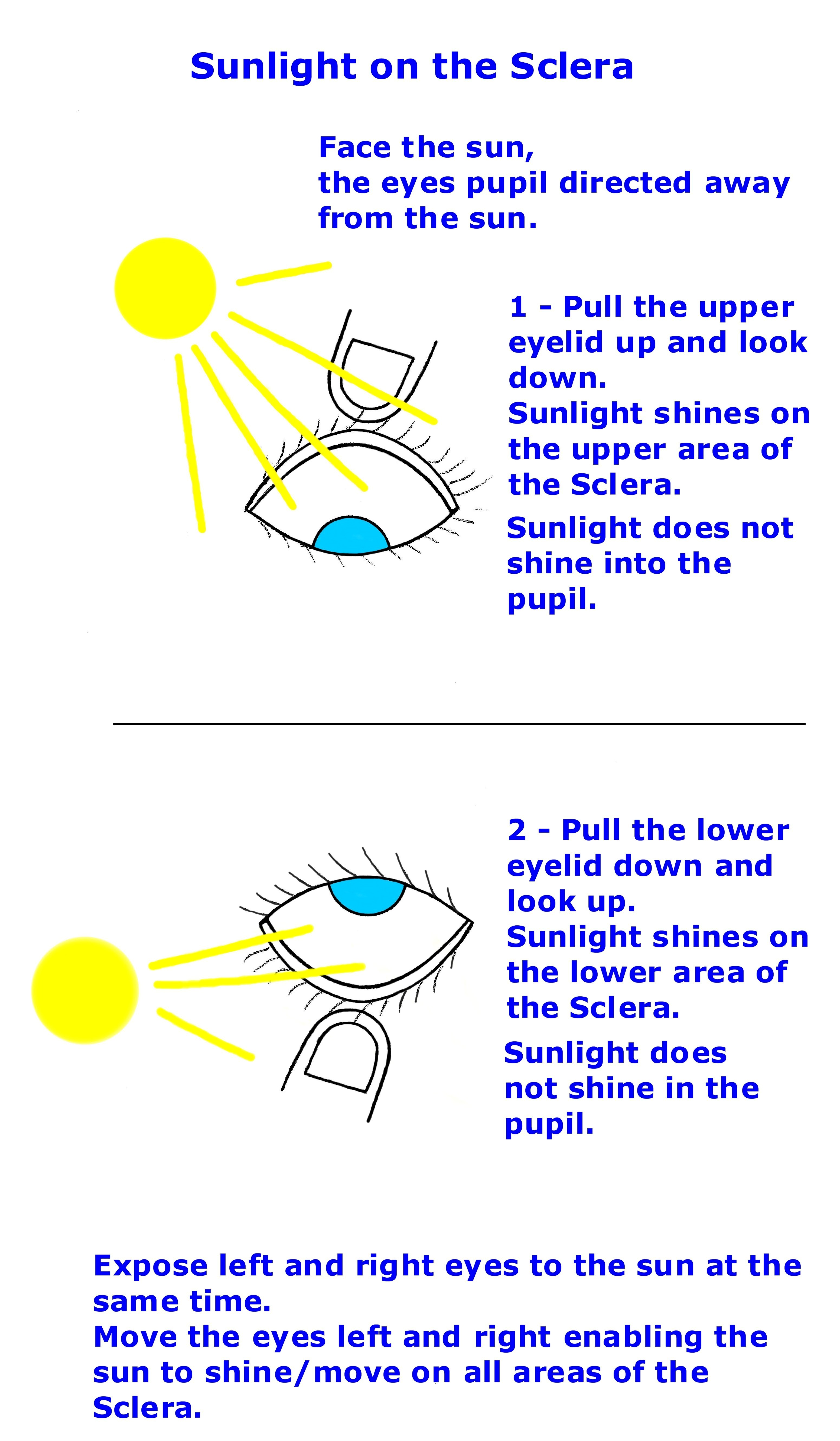 Sunlight_treatment.jpg